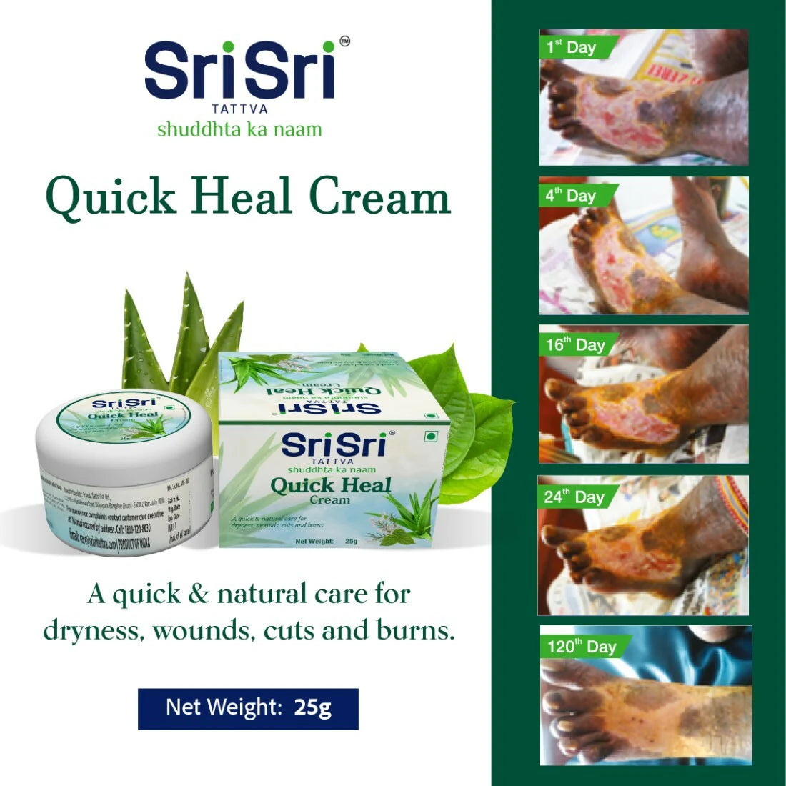 Sri Sri Tattva Quick Heal Cream - 25gm Cream