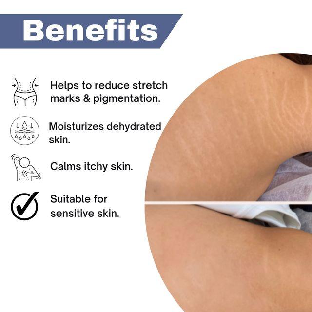 Zenius Anti Stretch Marks Oil - 50ml Oil