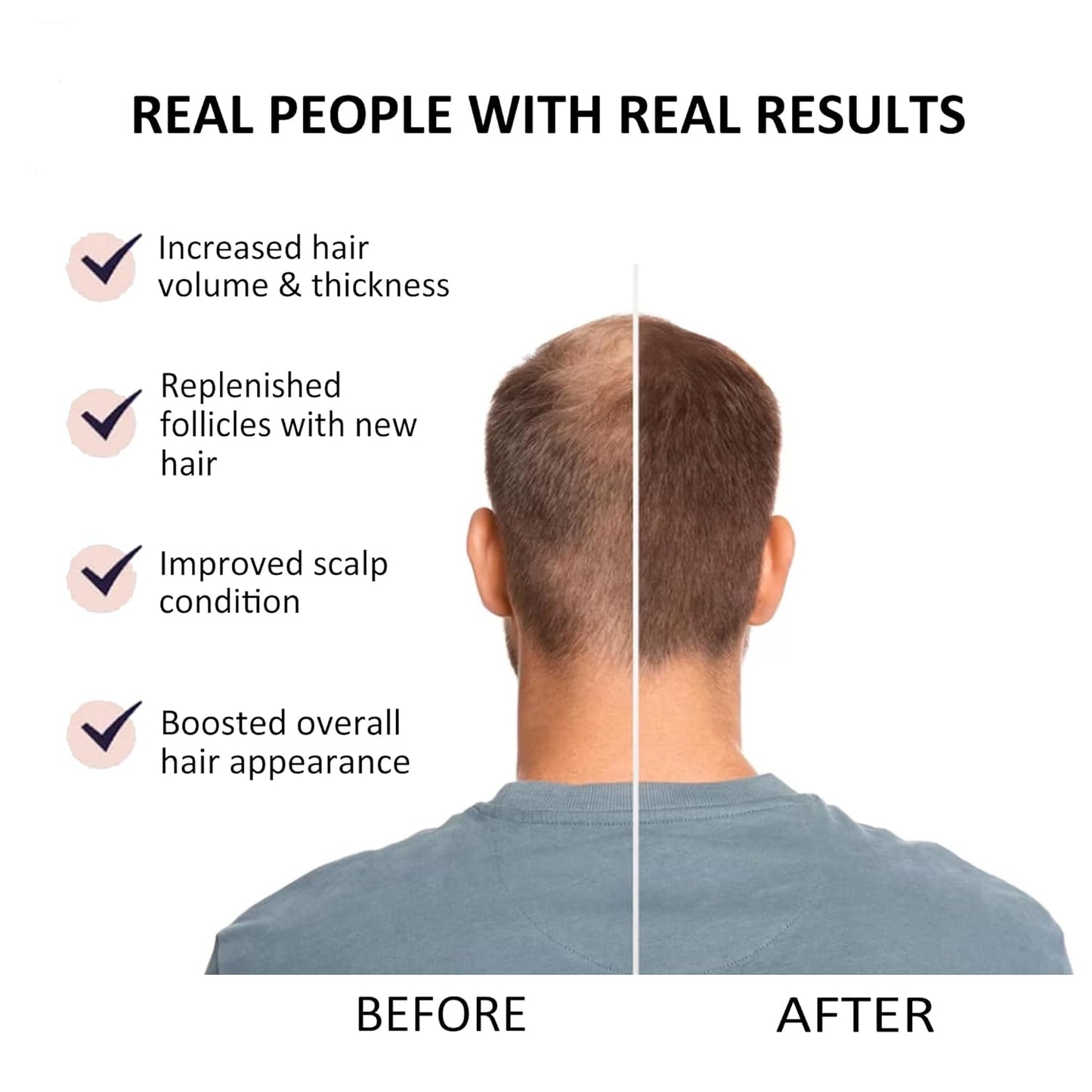 Beauty Secrets Saw Palmetto Serum - 30ml