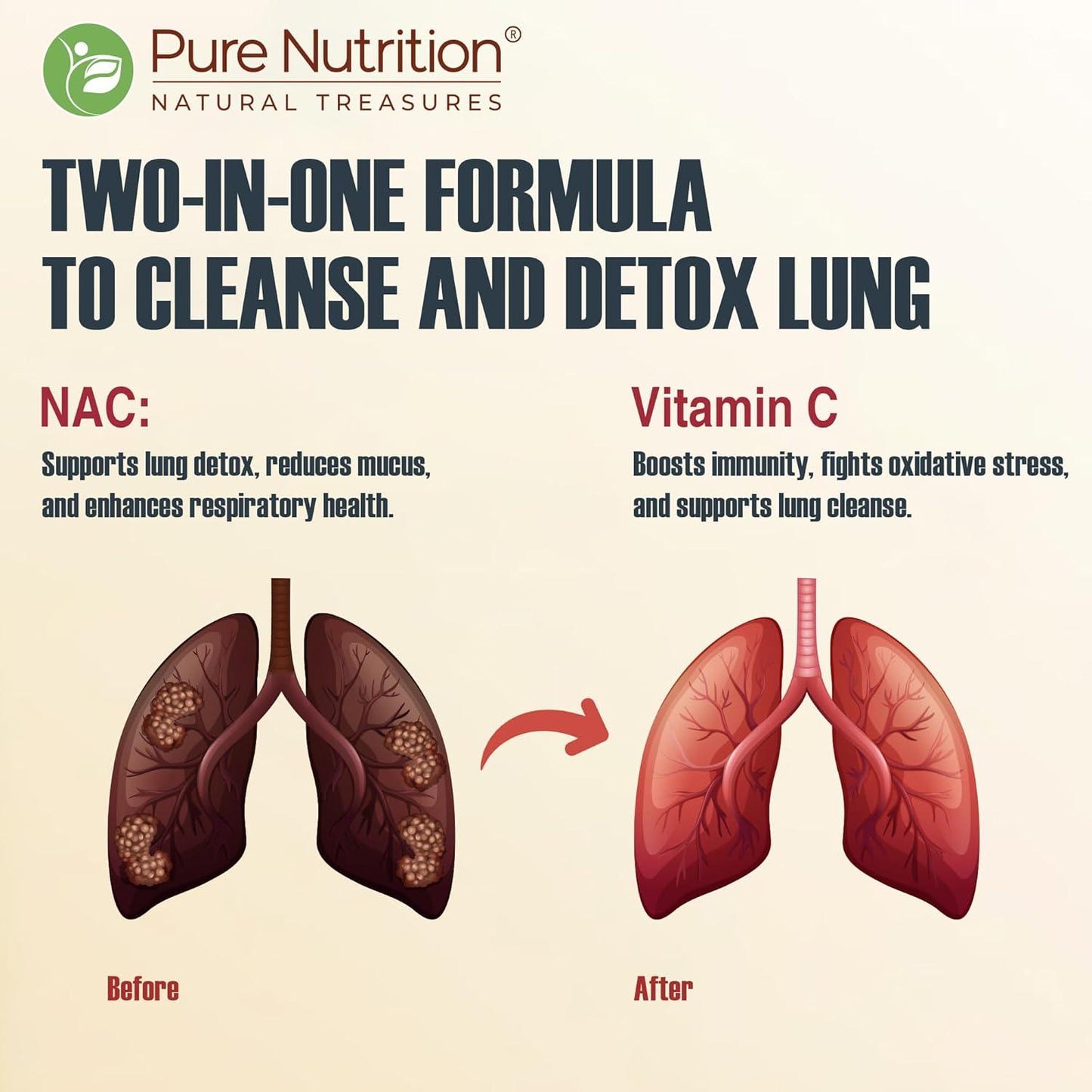 Pure Nutrition Lung Detox Effervescent Tablets (Lemon Flavor) - 20 Tablets