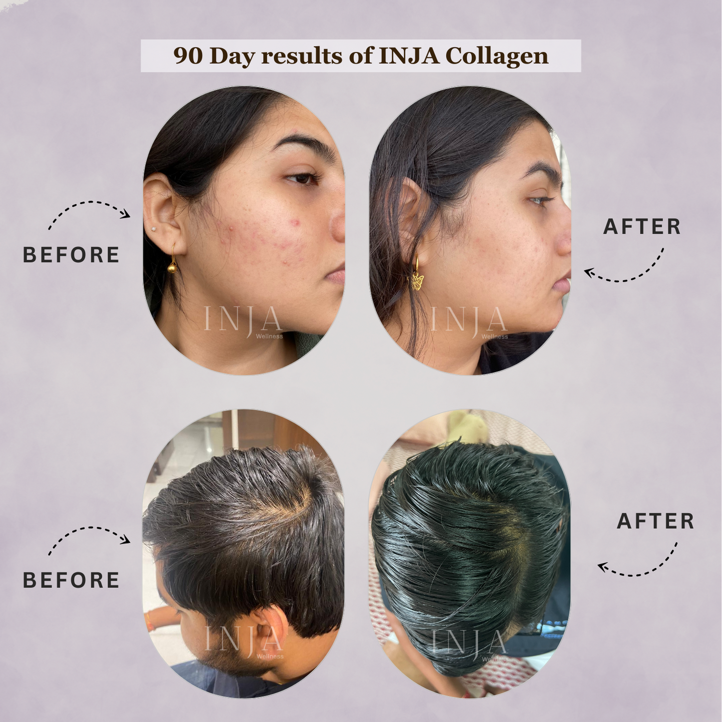 Inja Fit Collagen Powder for Muscle, Joint & Tissue Health | Flavour Powder Chocolate - 250gm Powder