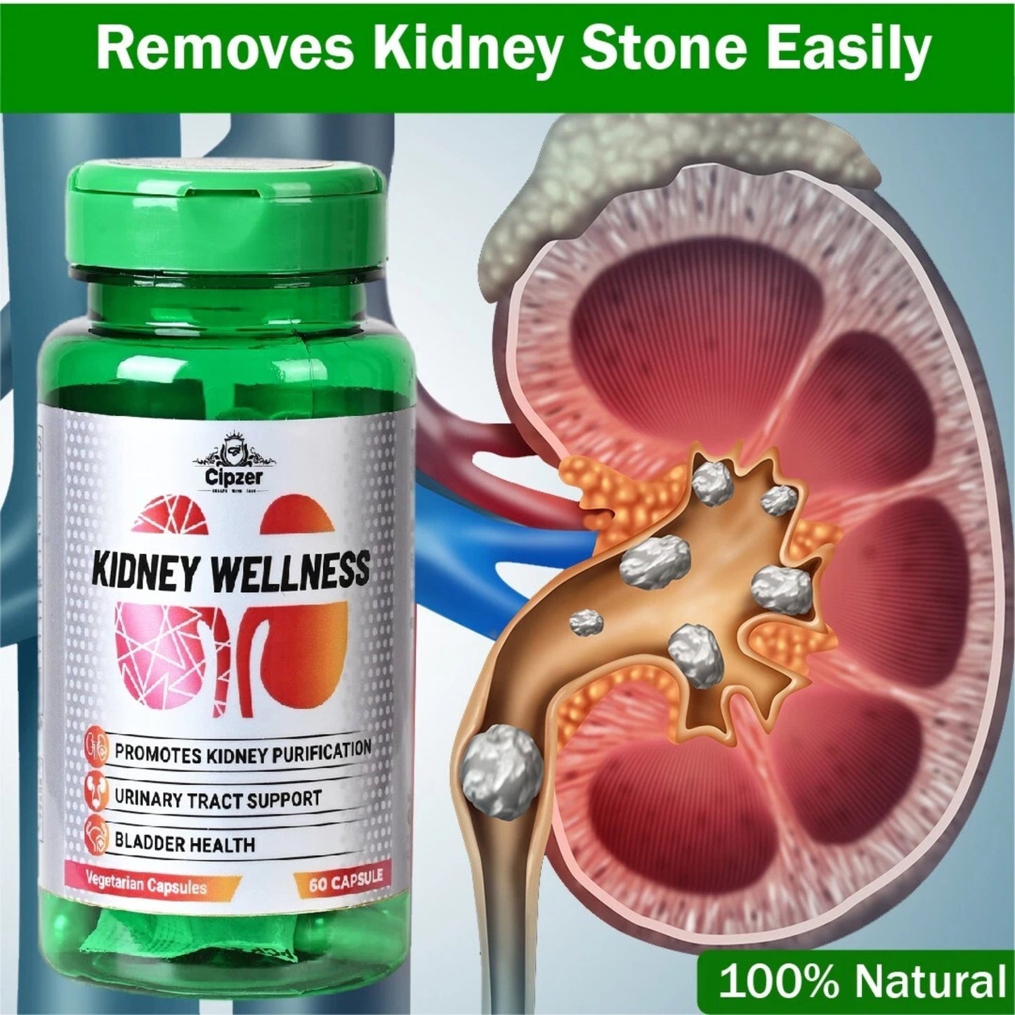 Cipzer Kidney Wellness 60 Capsules | Herbal Support For Kidney Stones, Urinary Tract & Detox Health