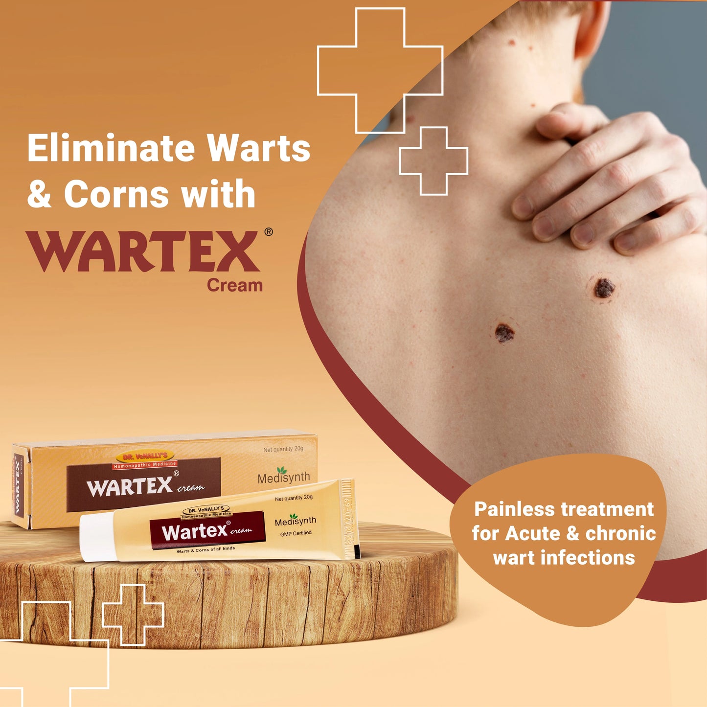 Medisynth Wartex Cream - 25gm