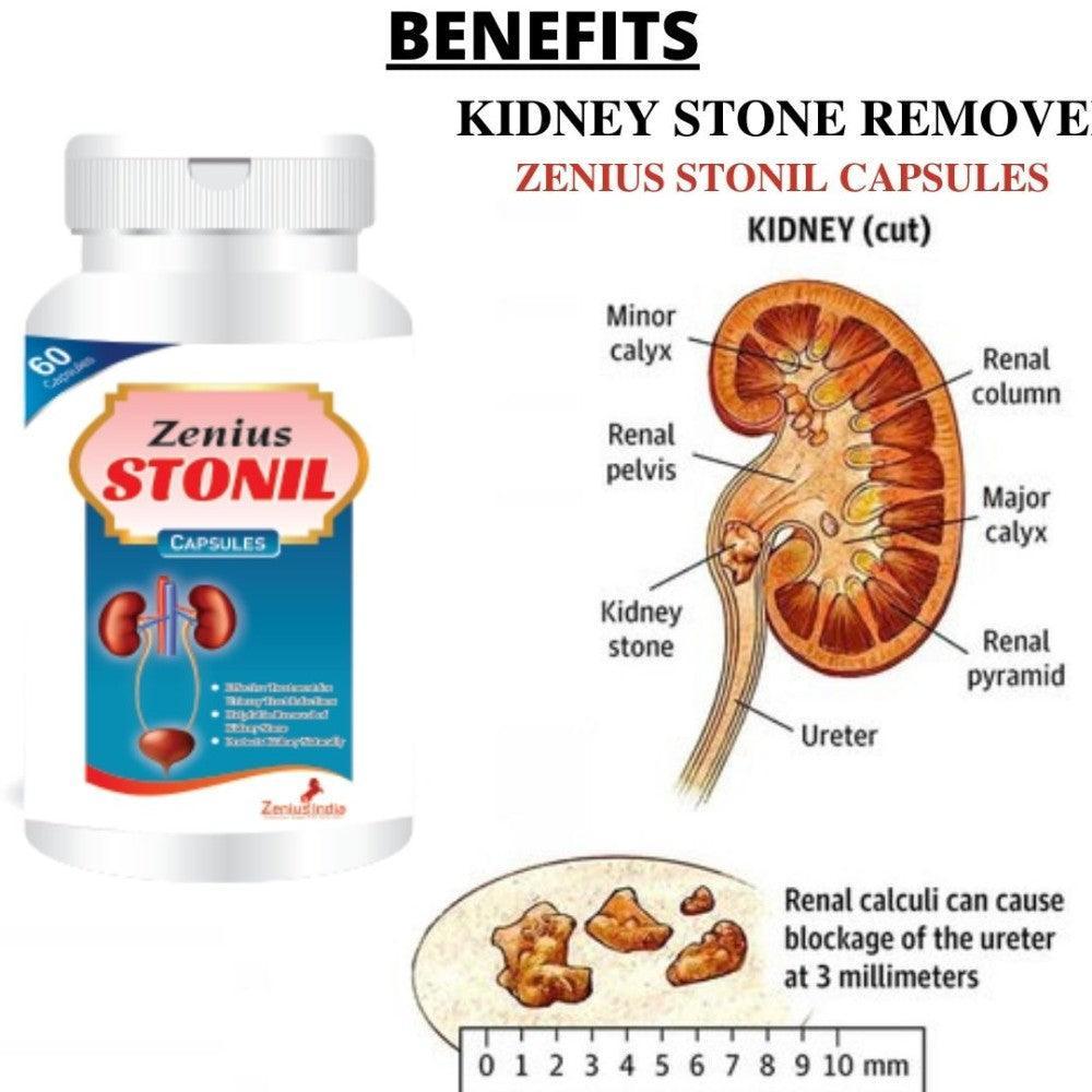 Zenius Stonil Capsule (60 Capsules)