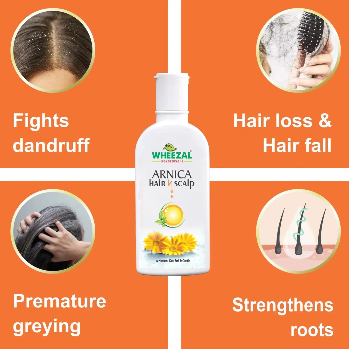 Wheezal Arnica Hair N Scalp Treatment Shampoo