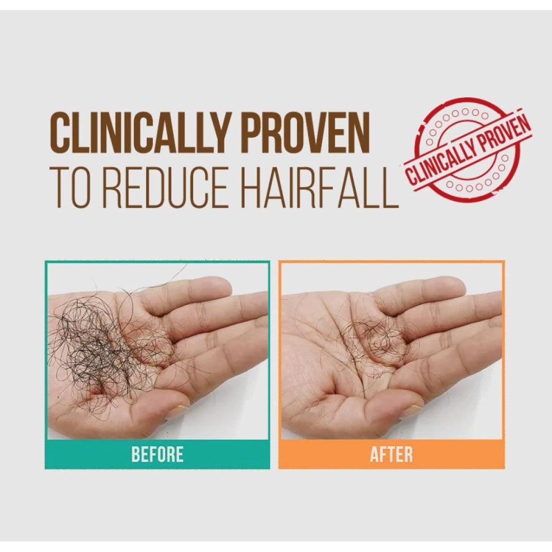 Zenius Hair Pro Oil for Hair Growth & Hair Fall Control - 100ml