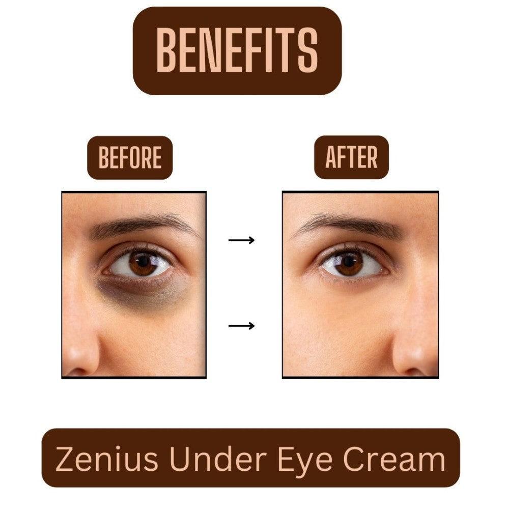 Zenius U-Eye Cream For Dark Circles, Wrinkles, Puffy Eyes