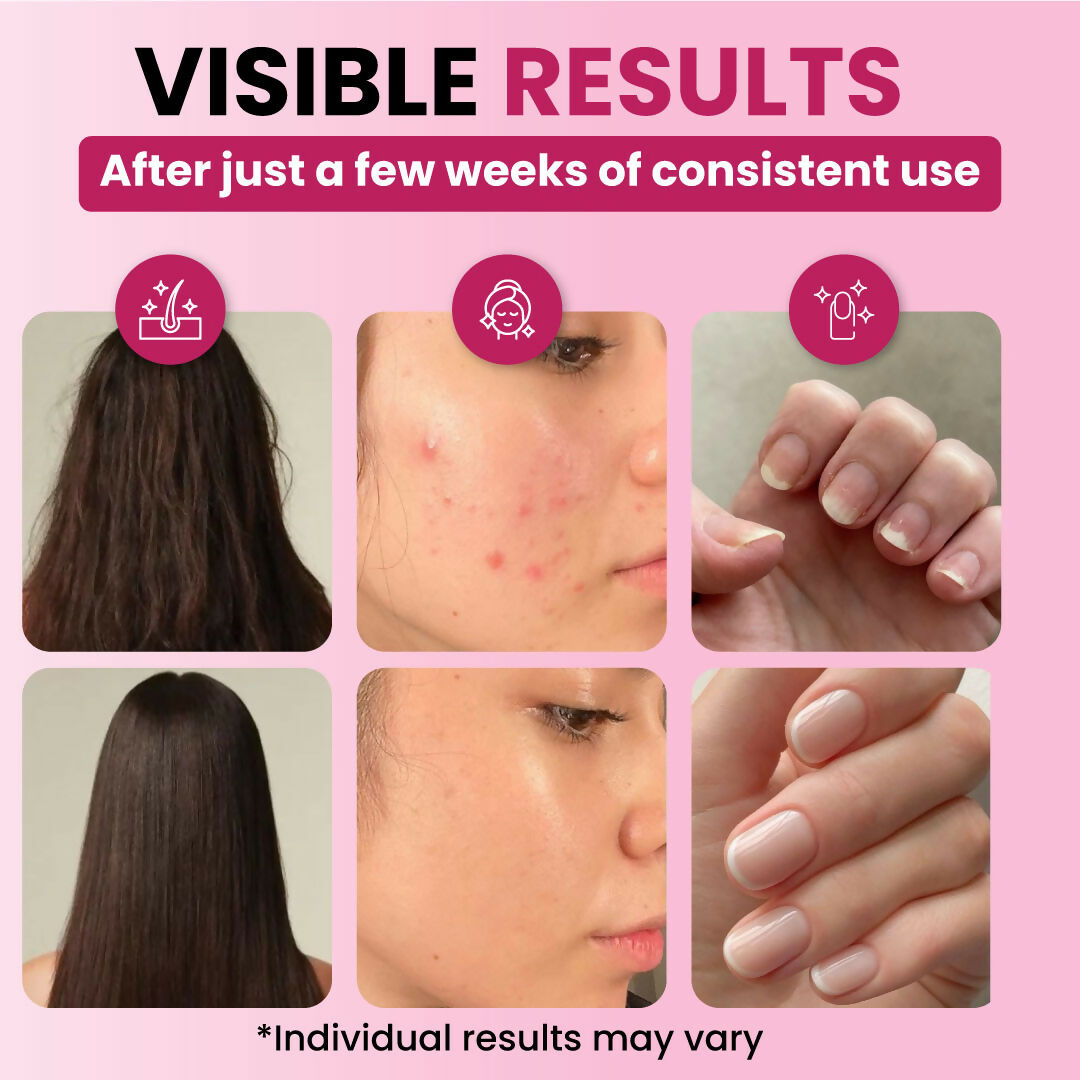 ZEROHARM Skin Radiance Supplement With L-Glutathione, Acerola Cherry Extract (Vitamin C), Vitamin B7(Biotin) & E - Helps Reduce Dark Spots, Brightens & Hydrates Skin for Men & Women - 60 Tablets