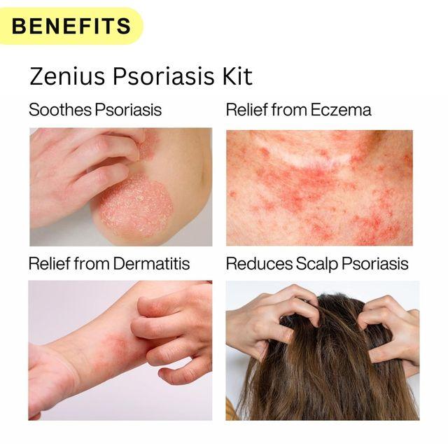 Zenius Psoriasis kit - Skin Psoriasis Medicine for Psoriasis Treatment and Skin Care