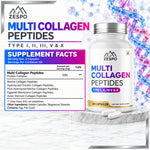 Zespo Multi Collagen Peptides Type I, II, III, V & X 1,200  Supports Skin, Hair, Nails, Joints & Bone Health – 120 Capsules