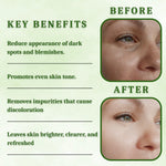 VASL Dark Spot Reduction Face Wash - Brightening Skin Cleanser for Dark Spots, 130ml
