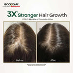 Goodcare Root Boost Hibiscus & Bhringraj Hair Oil - 100 ml