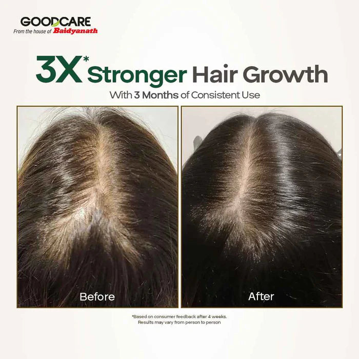 Goodcare Root Boost Hibiscus & Bhringraj Hair Oil - 100 ml