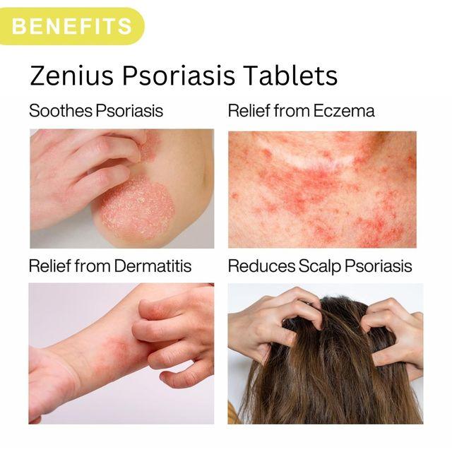 Zenius Psoriasis Tablet - Skin Psoriasis Tablets and Medicine for Psoriasis Relief - 60 Tablets