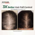 Goodcare Root Boost Rosemary & Curry Leaves Hair Oil - 100 ml