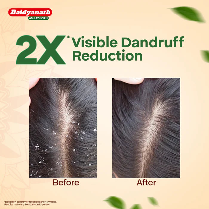 Baidyanath Curry Leaves Hair Oil - 200ml