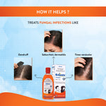 Lifezen Ketovate 2% Anti Fungal Shampoo 100ml | Medicated Solution For Dandruff & Seborthoeic dermatitis of scalp