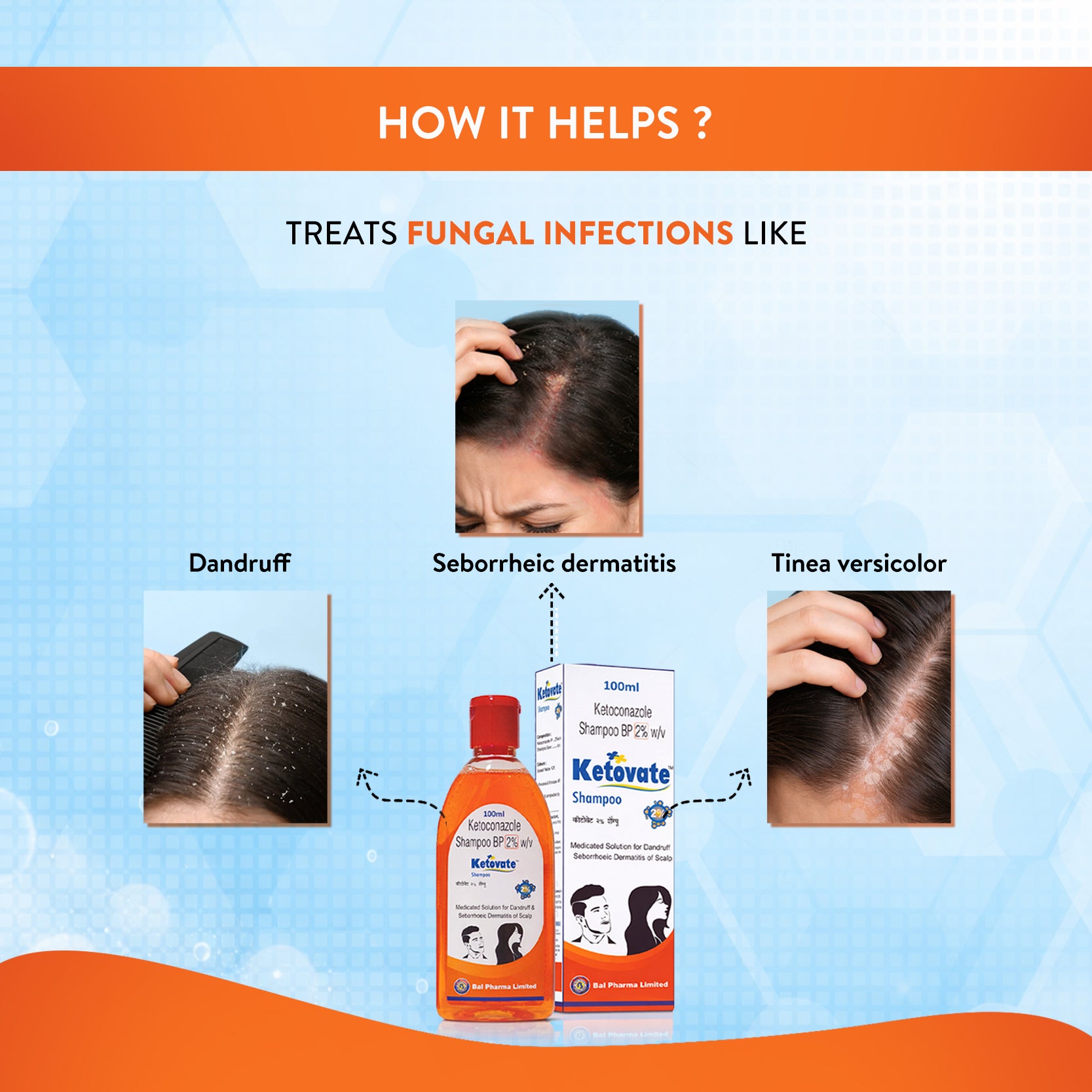 Lifezen Ketovate 2% Anti Fungal Shampoo 100ml | Medicated Solution For Dandruff & Seborthoeic dermatitis of scalp