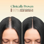Moha: 5-in-1 Hair Oil (200ml) - Ayurvedic Hair Growth Oil for Hairfall Control & Dandruff