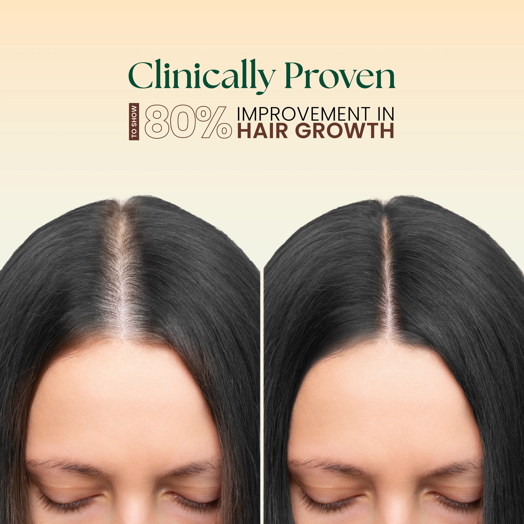 Moha: 5-in-1 Hair Oil (200ml) - Ayurvedic Hair Growth Oil for Hairfall Control & Dandruff