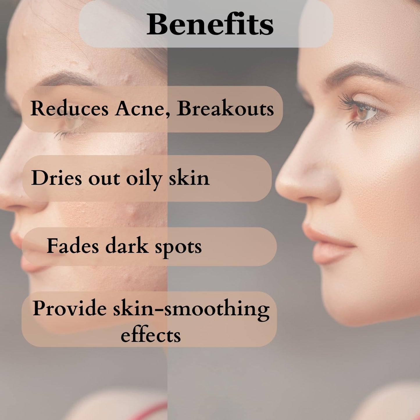 Dermistry Foaming Face Wash - 2% Salicylic Acid Anti Acne