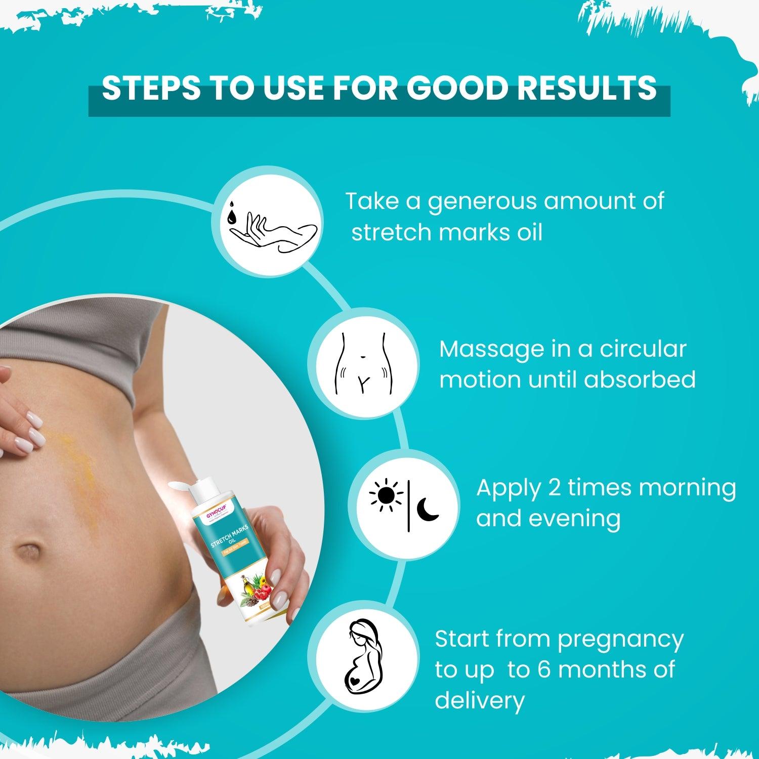 Gynocup Stretch Mark Removal Oil