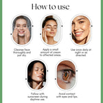 Kayee Ayurveda Acne Care Face Cream for Oily & Acne-Prone Skin | Helps Reduce the Appearance of Pimples, Blemishes & Excess Oil | Supports Clearer, Smoother & Healthier-Looking Skin | Daily Face Moisturizer for Women & Men | 50 g