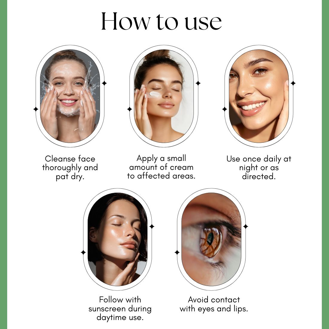 Kayee Ayurveda Acne Care Face Cream for Oily & Acne-Prone Skin | Helps Reduce the Appearance of Pimples, Blemishes & Excess Oil | Supports Clearer, Smoother & Healthier-Looking Skin | Daily Face Moisturizer for Women & Men | 50 g