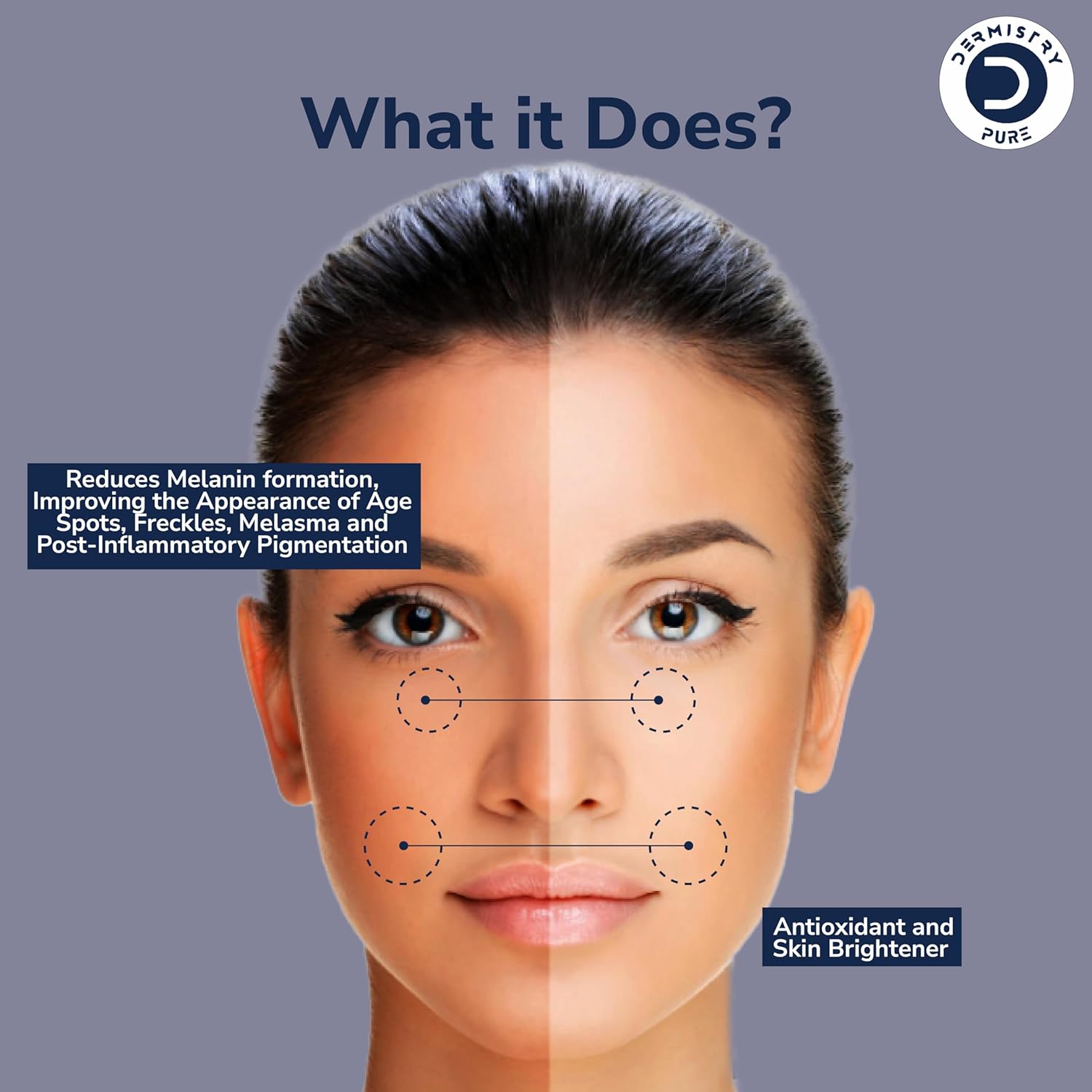 Dermistry Pure 2% Kojic Acid 1% Alpha Arbutin Pigmentation Face Serum