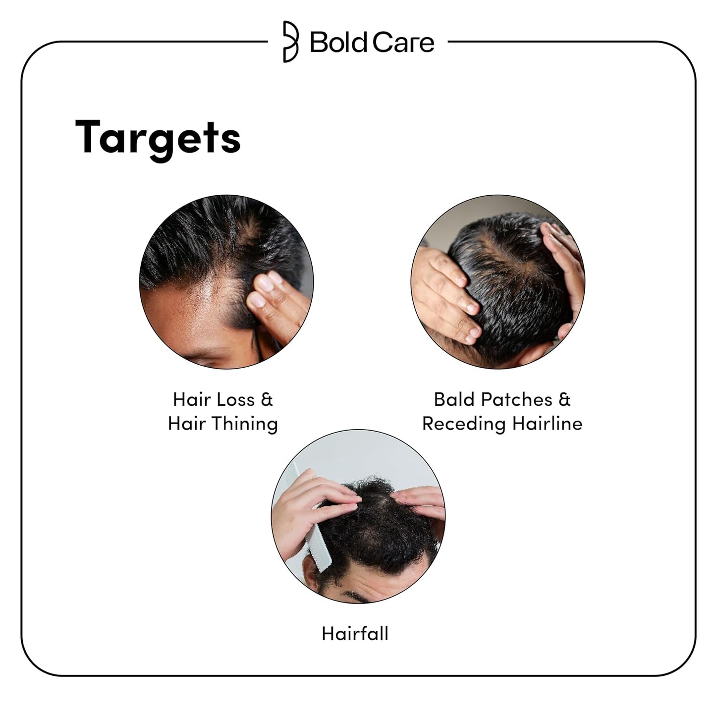Bold Care Advanced Hair Growth Serum For Men (30 ml)