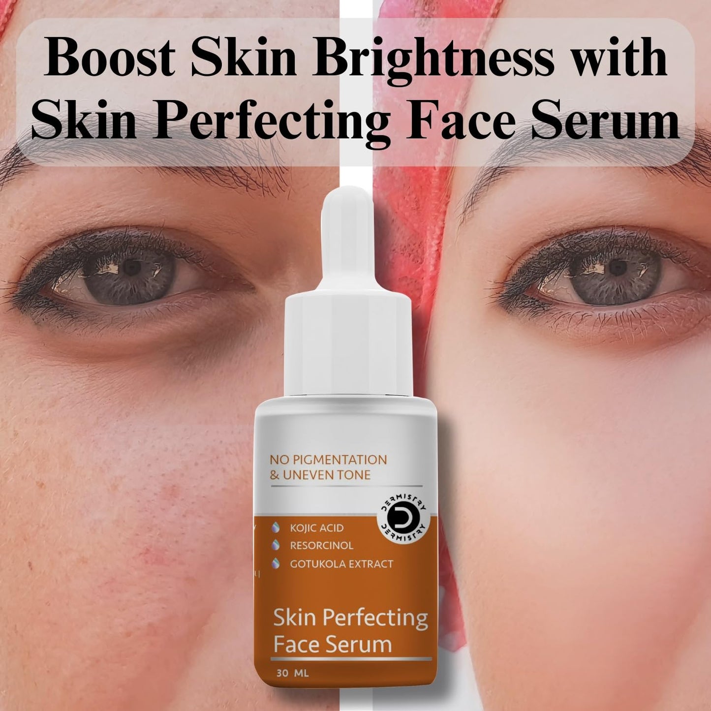 Dermistry No Pigmentataion & Uneven Tone Kojic Acid Skin Perfecting Face Serum - 30ml