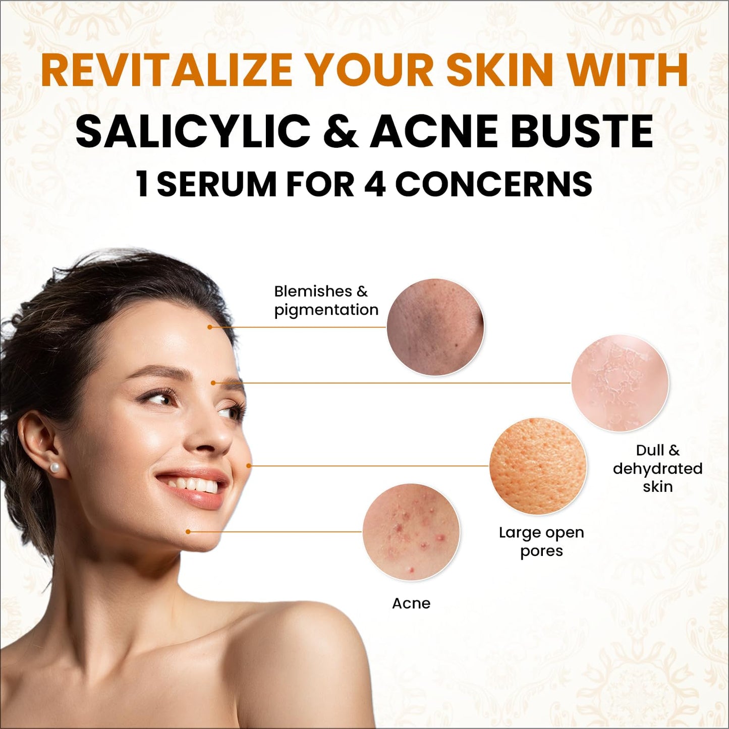 myUpchar 2% Salicylic Acid Face Serum Used for Acne, Oily Skin, Blackheads, Tightens Pores, Blemishes & Dark Spots Reduction - 50ml