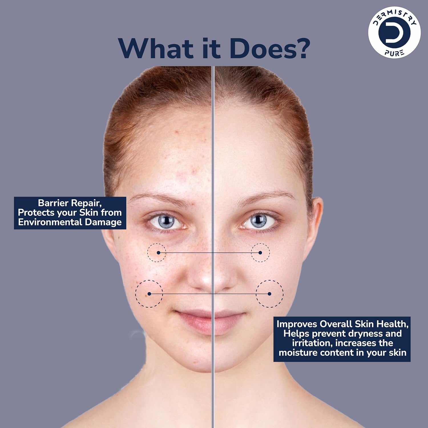 Dermistry 1% Ceramide 2% Hyaluronic Acid Serum