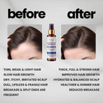 VASL Rosemary Hair Growth Mist 130ml - Anti Hair Fall & Dandruff Spray
