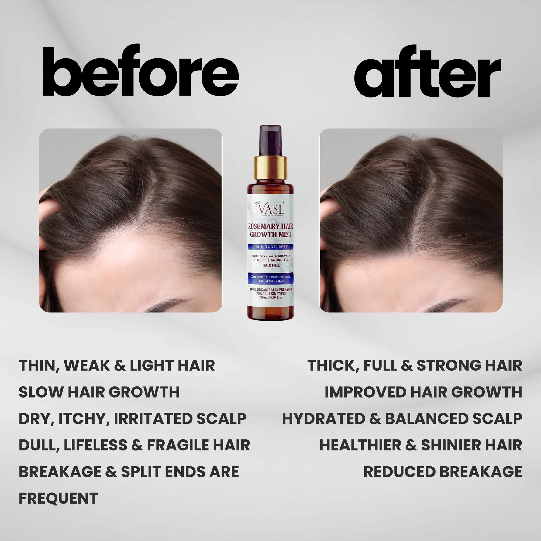 VASL Rosemary Hair Growth Mist 130ml - Anti Hair Fall & Dandruff Spray