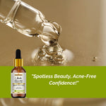 Khadi Acne & Spot Face Serum for Acne & Dark Spots | Pimple, Blemish & Acne Mark Care Serum | Oil Control & Even Skin Tone | Lightweight & Non-Greasy Formula | 30 ml
