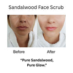 Kayee Ayurveda Sandalwood Herbal Face Scrub | Chandan Facial Exfoliator for Gentle Dead Skin Removal, Skin Polishing & Deep Cleansing | Helps Improve the Appearance of Dull & Rough-Looking Skin | Leaves Face Soft, Smooth & Naturally Radiant