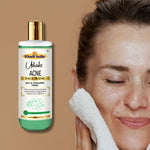 Utkrisht Khadi Acne Face Wash (200ml)