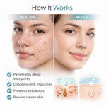 Kayee Ayurveda 2% Salicylic Acid Face Serum for Acne-Prone & Oily Skin | Helps Unclog Pores, Control Excess Oil & Improve the Appearance of Blemishes | Lightweight Daily Facial Serum for Women & Men | 30 ml