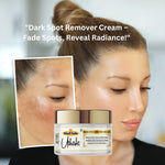 Utkrisht Khadi Dark Spot & De-Pigmentation Cream (50g) | Reduces Acne Marks, Sun Spots & Uneven Skin Tone