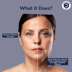 Dermistry Pure 2% Retinol 2% Hyaluronic Acid Anti Aging Face Serum