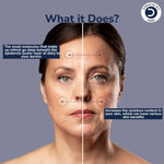 Dermistry Pure 1% Retinol 2% Hyaluronic Acid Anti Aging Face Serum