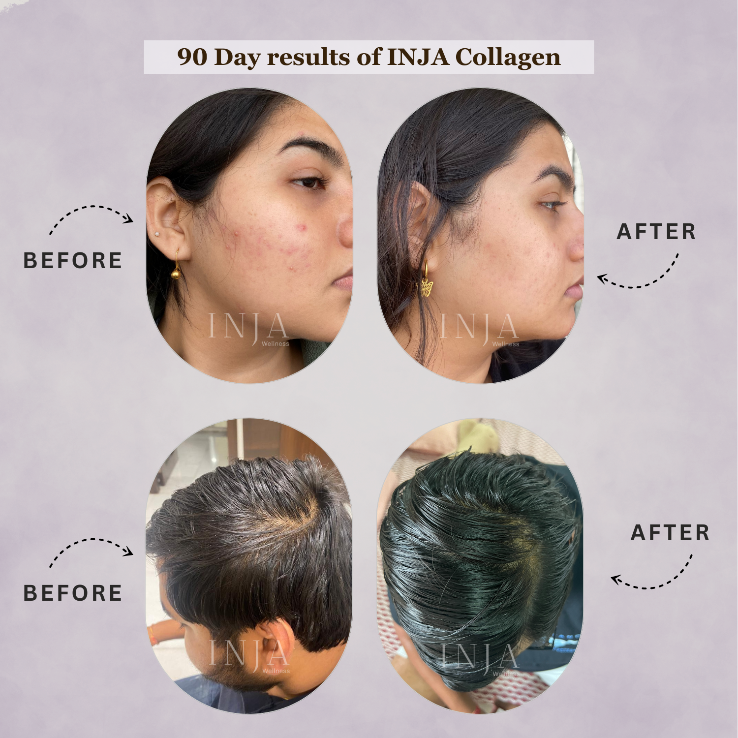 Inja Fit Collagen Powder for Muscle, Joint & Tissue Health | Flavour Powder Chocolate - 250gm Powder