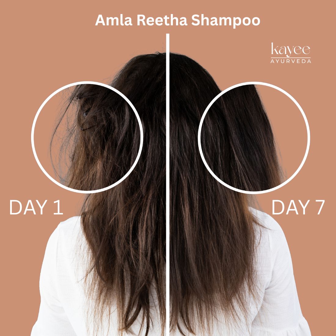 Kayee Ayurveda Amla Reetha Hair Shampoo for Strong & Healthy-Looking Hair | Herbal Shampoo for Scalp & Hair Care | Amla & Reetha Formula for Gentle Cleansing, Hair Conditioning, Softness & Healthy-Looking Shine | 210 ml