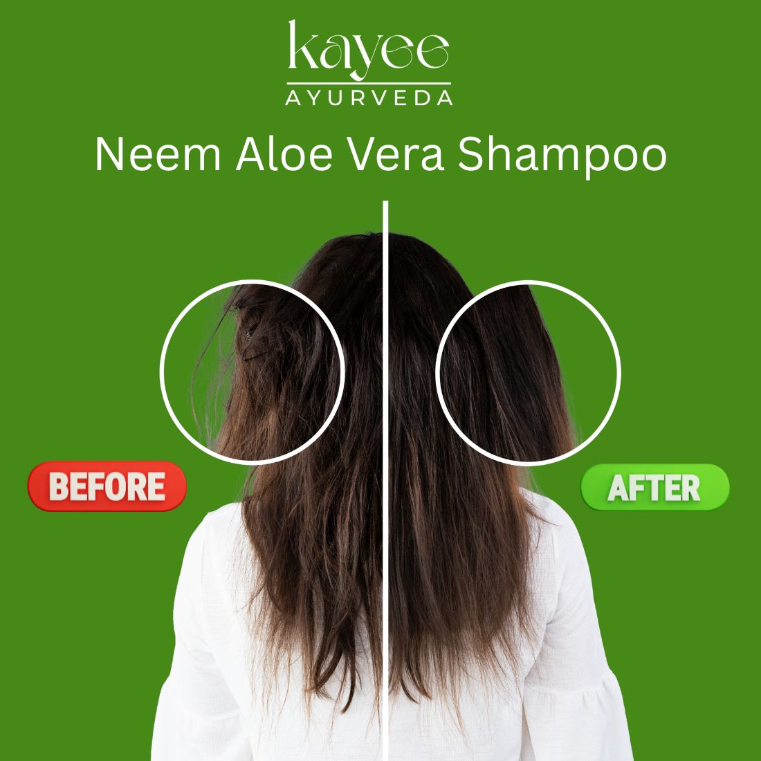Kayee Ayurveda Neem Aloe Vera Shampoo for Men & Women | Herbal Hair Cleanser for Scalp Care | Neem & Aloe Vera Formula Helps Cleanse Dirt, Excess Oil & Impurities While Maintaining Soft, Fresh & Manageable Hair | 210 ml