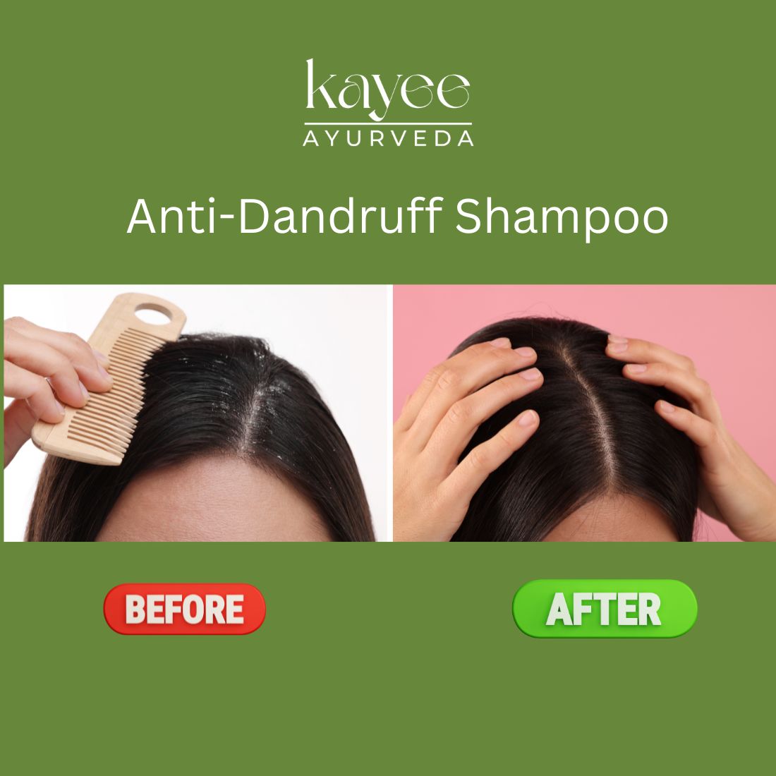 Kayee Ayurveda Anti-Dandruff Shampoo for Men & Women | Herbal Scalp Cleansing Shampoo for Dandruff & Flaky Scalp Care | Helps Remove Excess Oil, Cleanse Scalp & Maintain Fresh, Healthy-Looking Hair | 210 ml