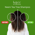 Kayee Ayurveda Neem & Tea Tree Herbal Shampoo | Scalp Care Shampoo for Oily, Dull & Flaky-Looking Scalp | Herbal Hair Cleanser for Freshness, Cleansing, Hair Conditioning & Healthy-Looking Shine | 210 ml