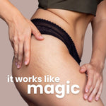 Gynocup Stretch Mark Removal Oil