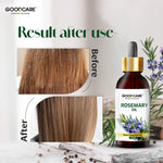 Goodcare Rosemary Essential Oil 15 Ml For Stronger & Healthier Hair
