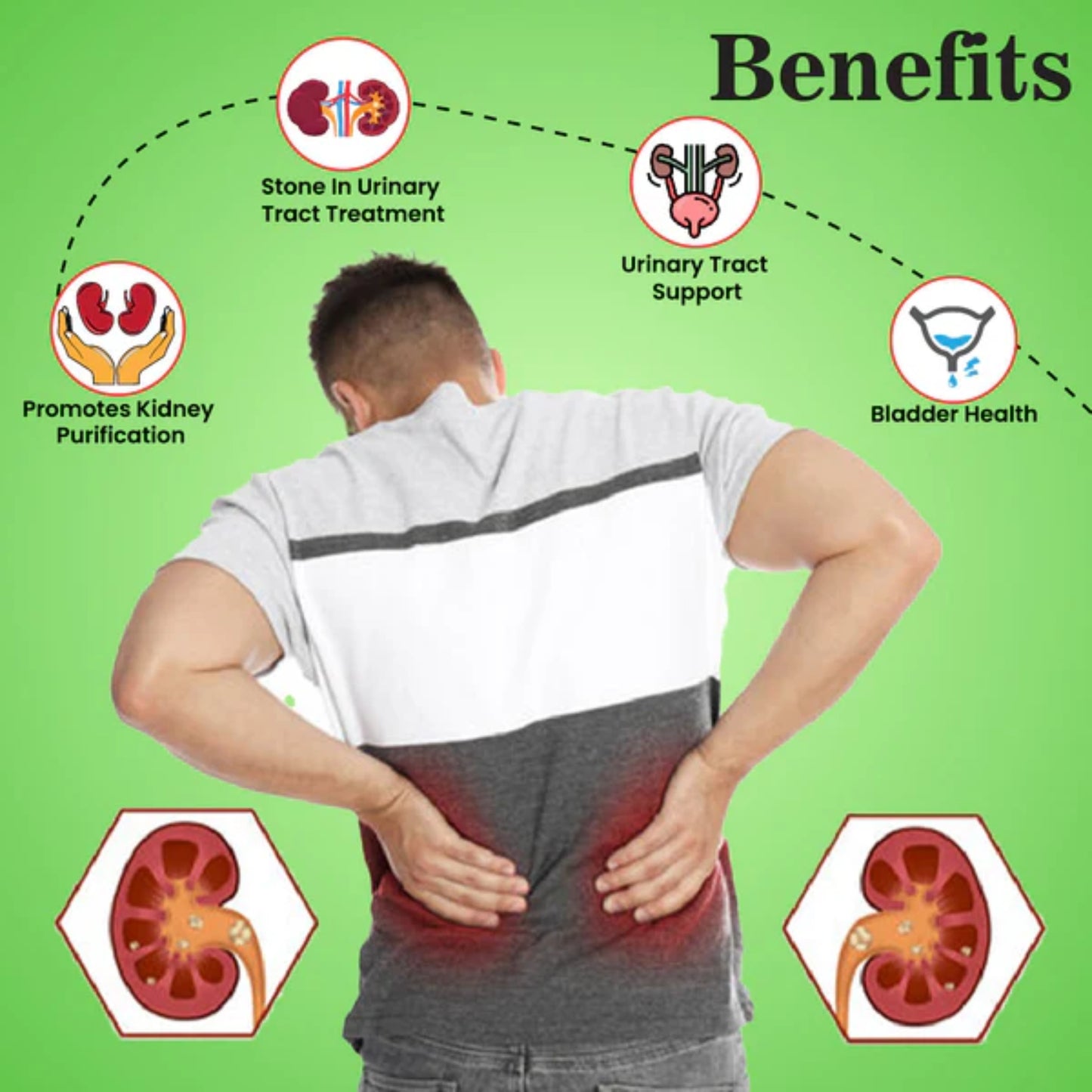 Cipzer Majoon-E-Hajr-Ul-Yahood - 125gm | Herbal Remedy for Kidney Stones, Urinary Tract & Detox